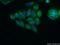 ADP Ribosylation Factor GTPase Activating Protein 1 antibody, 13571-1-AP, Proteintech Group, Immunofluorescence image 