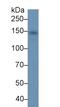 Retinol Binding Protein 4 antibody, abx132035, Abbexa, Western Blot image 