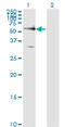 Frizzled Class Receptor 5 antibody, LS-C198504, Lifespan Biosciences, Western Blot image 