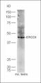 ERCC Excision Repair 8, CSA Ubiquitin Ligase Complex Subunit antibody, orb156770, Biorbyt, Western Blot image 
