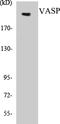 TSC Complex Subunit 2 antibody, EKC1579, Boster Biological Technology, Western Blot image 