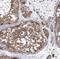 VPS37B Subunit Of ESCRT-I antibody, NBP1-82283, Novus Biologicals, Immunohistochemistry paraffin image 