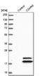 ECRG4 Augurin Precursor antibody, NBP1-84911, Novus Biologicals, Western Blot image 