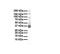 Potassium Voltage-Gated Channel Subfamily A Regulatory Beta Subunit 2 antibody, ARP37678_P050, Aviva Systems Biology, Western Blot image 