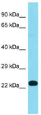 Fructosamine 3 Kinase antibody, TA344688, Origene, Western Blot image 