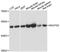 NADH:Ubiquinone Oxidoreductase Core Subunit S2 antibody, A12858, ABclonal Technology, Western Blot image 