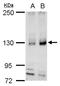 RE1 Silencing Transcription Factor antibody, GTX129144, GeneTex, Western Blot image 