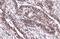Forkhead Box M1 antibody, GTX102126, GeneTex, Immunohistochemistry paraffin image 