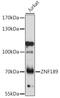 Zinc Finger Protein 189 antibody, 16-609, ProSci, Western Blot image 