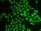 Ubiquitin Conjugating Enzyme E2 V1 antibody, GTX16444, GeneTex, Immunocytochemistry image 