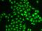 Ubiquitin-conjugating enzyme E2 variant 1 antibody, GTX16444, GeneTex, Immunocytochemistry image 