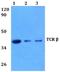 T Cell Receptor Beta Constant 1 antibody, A15765-1, Boster Biological Technology, Western Blot image 