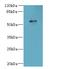 G Protein-Coupled Receptor 176 antibody, A64742-100, Epigentek, Western Blot image 