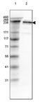 Spectrin Beta, Non-Erythrocytic 1 antibody, PA5-53024, Invitrogen Antibodies, Western Blot image 
