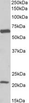 Solute Carrier Family 1 Member 3 antibody, LS-C186488, Lifespan Biosciences, Western Blot image 