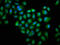 Gelsolin antibody, CSB-PA009965HA01HU, Cusabio, Immunofluorescence image 