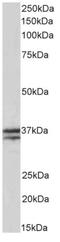 Troponin T1, Slow Skeletal Type antibody, AP33501PU-N, Origene, Western Blot image 