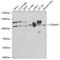 Catenin Delta 1 antibody, 16-592, ProSci, Western Blot image 
