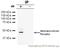 Eukaryotic Translation Initiation Factor 4A2 antibody, ab31218, Abcam, Immunoprecipitation image 