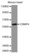 Dihydropyrimidinase Like 3 antibody, MBS127765, MyBioSource, Western Blot image 