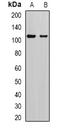 Adaptor Related Protein Complex 2 Subunit Alpha 2 antibody, LS-C482433, Lifespan Biosciences, Western Blot image 