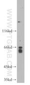 Myosin Light Chain Kinase 2 antibody, 21173-1-AP, Proteintech Group, Western Blot image 