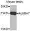 AlkB Homolog 7 antibody, PA5-76222, Invitrogen Antibodies, Western Blot image 