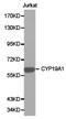 Cytochrome P450 Family 19 Subfamily A Member 1 antibody, LS-C192750, Lifespan Biosciences, Western Blot image 