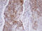 Mitochondrial Translational Initiation Factor 3 antibody, LS-C175284, Lifespan Biosciences, Immunohistochemistry paraffin image 