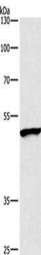 Bone Morphogenetic Protein 15 antibody, TA349718, Origene, Western Blot image 