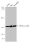 Phosphoinositide-3-Kinase Regulatory Subunit 4 antibody, GTX132466, GeneTex, Western Blot image 
