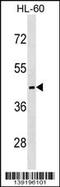 Melanocortin receptor 5 antibody, 60-232, ProSci, Western Blot image 