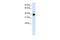 Homeobox A11 antibody, GTX48983, GeneTex, Western Blot image 