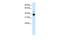 Homeobox A11 antibody, GTX48983, GeneTex, Western Blot image 