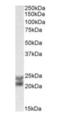 Caveolin 1 antibody, orb19043, Biorbyt, Western Blot image 