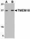 Transmembrane Protein 18 antibody, LS-B4991, Lifespan Biosciences, Western Blot image 