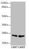 TNF Alpha Induced Protein 8 antibody, LS-C676614, Lifespan Biosciences, Western Blot image 