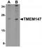 Transmembrane Protein 147 antibody, TA319817, Origene, Western Blot image 