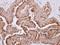 Carboxylesterase 2 antibody, NBP2-15864, Novus Biologicals, Immunohistochemistry paraffin image 