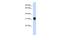 Dynein Axonemal Light Intermediate Chain 1 antibody, A12015, Boster Biological Technology, Western Blot image 