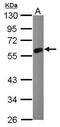 Mig6 antibody, PA5-31137, Invitrogen Antibodies, Western Blot image 
