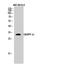 Protein Phosphatase 1 Regulatory Inhibitor Subunit 1B antibody, STJ92655, St John