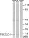 TSC22 Domain Family Member 1 antibody, LS-B8419, Lifespan Biosciences, Western Blot image 