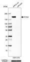 Ataxin 2 antibody, NBP1-90063, Novus Biologicals, Western Blot image 