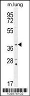 Twinfilin Actin Binding Protein 2 antibody, 55-971, ProSci, Western Blot image 