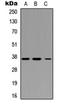 Frizzled Class Receptor 4 antibody, orb234853, Biorbyt, Western Blot image 