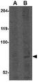 CCR4-NOT Transcription Complex Subunit 4 antibody, GTX85379, GeneTex, Western Blot image 