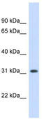 Dehydrodolichyl Diphosphate Synthase Subunit antibody, TA346836, Origene, Western Blot image 