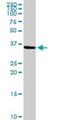 ADP/ATP translocase 3 antibody, H00000293-D01P, Novus Biologicals, Western Blot image 