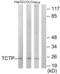 Fortilin antibody, LS-B8403, Lifespan Biosciences, Western Blot image 